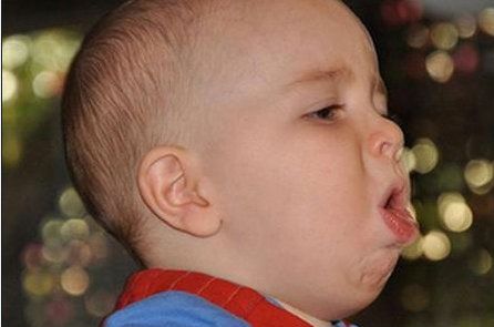 Tình trạng nôn trớ ở trẻ và cách phòng tránh