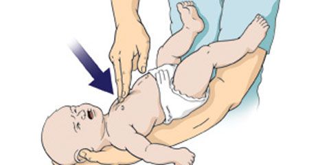 xu-ly-khi-be-bi-hoc-3