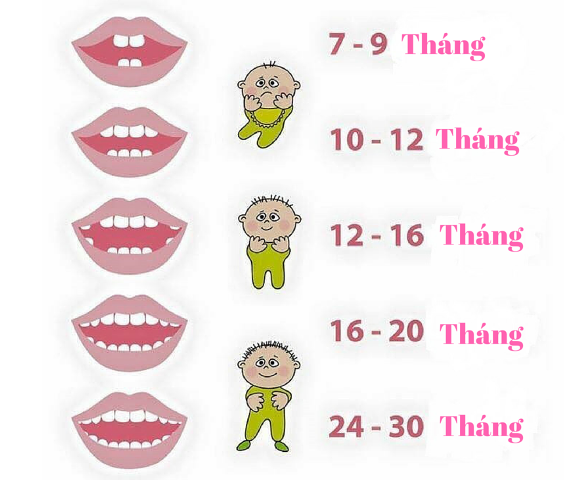 Theo dõi trình tự mọc răng sữa của bé để kịp thời “ứng phó”